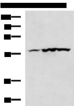 Polyclonal Rabbit anti-Human CAMK2G / CaMK II Gamma Antibody (WB)