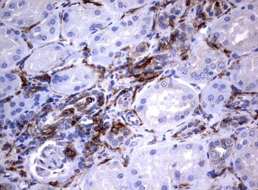 FCGR1A / CD64 Antibody (clone UMAB74, Carrier-free)