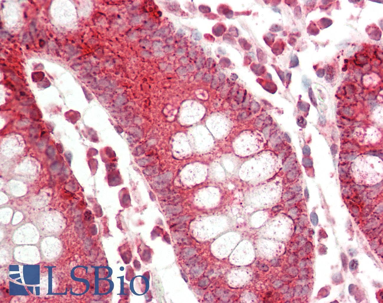 RHOB Antibody (aa107-156)