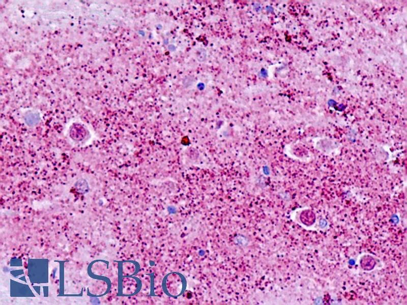 IHC-plus™ GPR173 / SREB3 Antibody (C-Terminus)