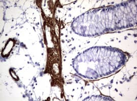 Hamartin / TSC1 Antibody (clone OTI3A2)