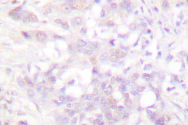 Polyclonal Rabbit anti-Human POLR2A / RNA polymerase II Antibody (Pro1613, IHC, IF, WB)