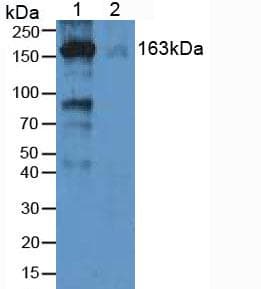 A2M / Alpha-2-Macroglobulin Antibody (aa616-856)