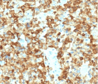 Monoclonal Mouse anti-Human PMEL / SILV / gp100 Antibody (clone MSSG95-2, IHC)