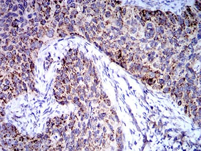 TRIM25 Antibody (clone 5B5B10)