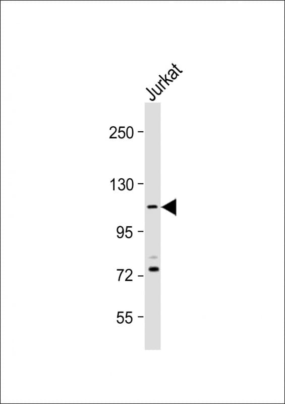 Polyclonal Rabbit anti-Human PKN1 Antibody (C-Terminus, IHC, IF, WB)