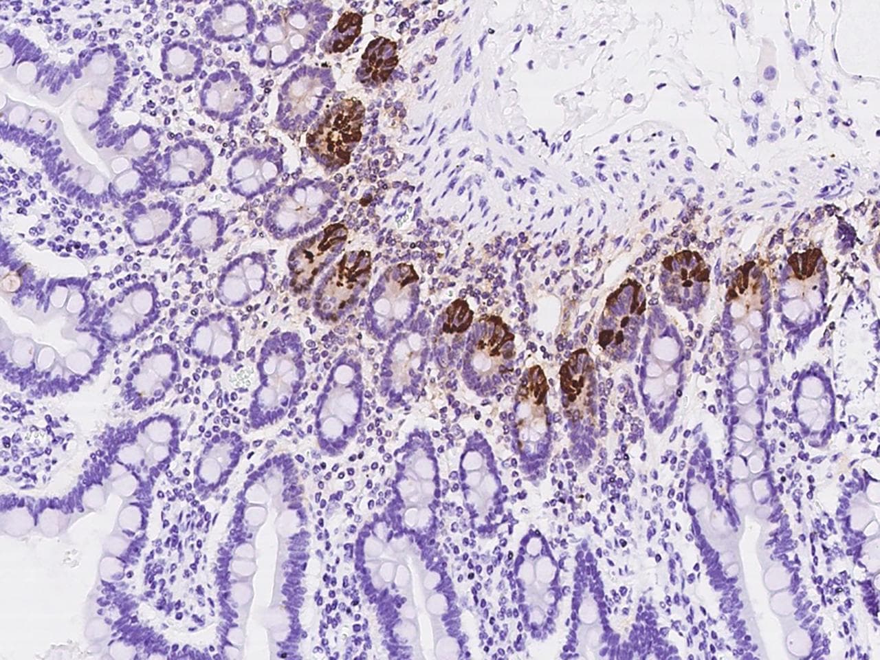 Polyclonal Rabbit anti-Human DEFA6 / Defensin 6 Antibody (IHC)