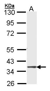 DMC1 Antibody (aa1-206)