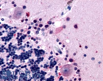 PathPlus™ Polyclonal Rabbit anti-Human MTNR1B / MT2 Antibody (Extracellular Domain, IHC)