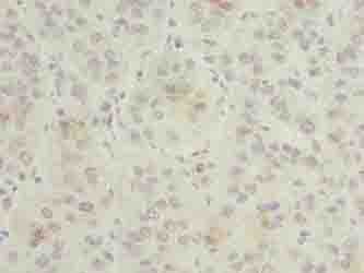Polyclonal Rabbit anti-Human GNG5 Antibody (IHC)