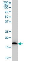 Monoclonal Mouse anti-Human NDUFS4 Antibody (clone 1A1, IHC, WB)