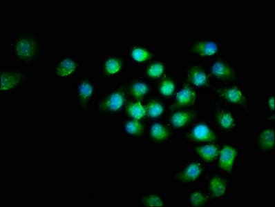 BIRC5 / Survivin Antibody