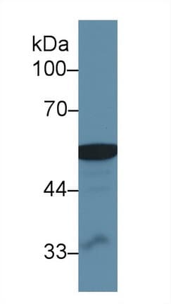 ALDH2 Antibody (aa59-150)