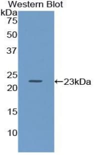 CD79A / CD79 Alpha Antibody (aa30-193)