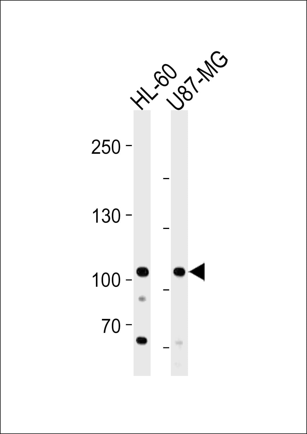 IHC-plus™ NXP2 / MORC3 Antibody (aa634-663)