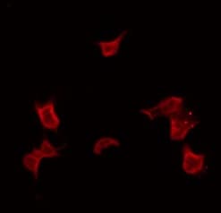 Polyclonal Rabbit anti-Human UBXN11 / SOC Antibody (IHC, IF, WB)