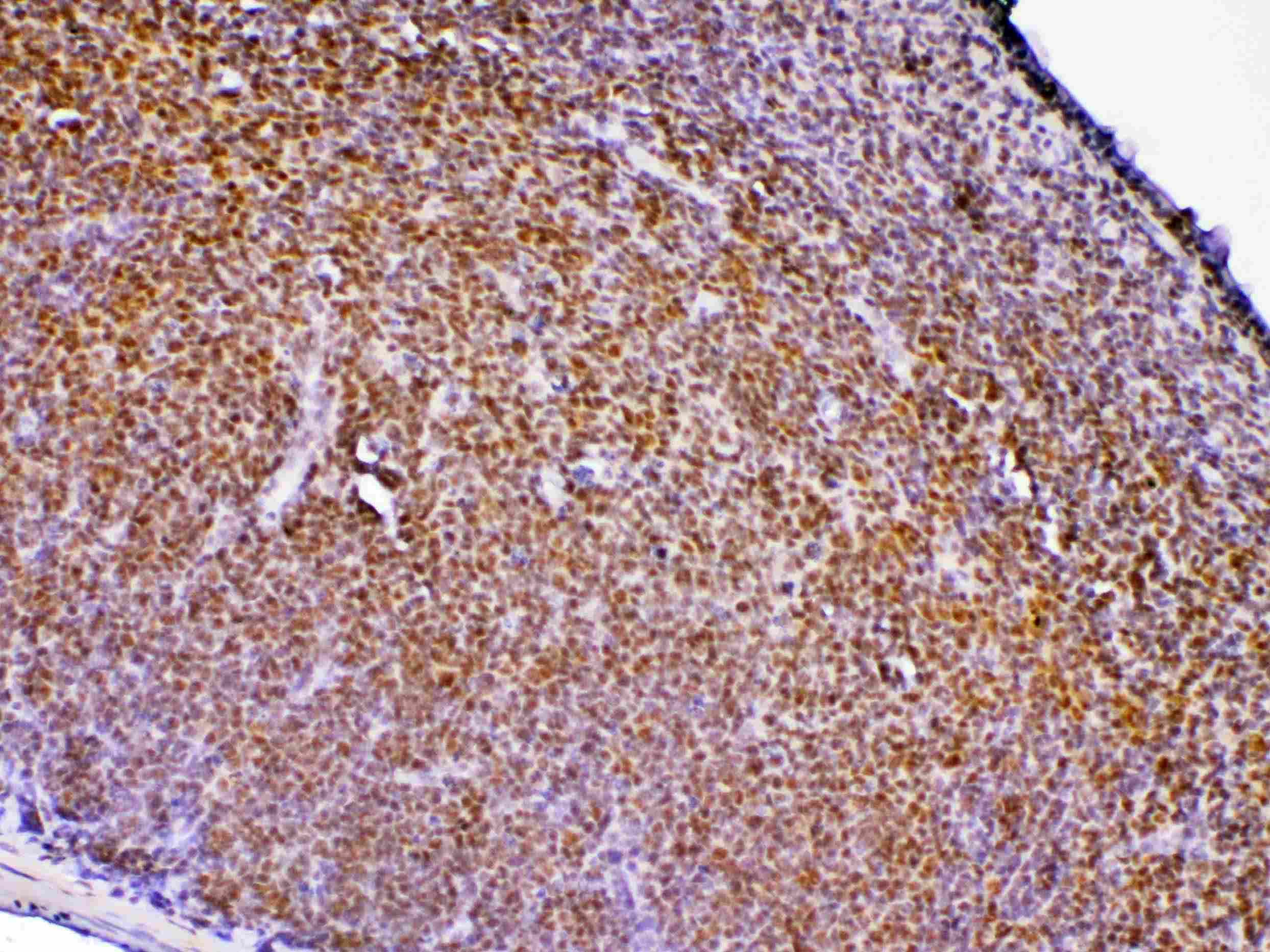 Polyclonal Rabbit anti-Mouse PTPN22 / PEP Antibody (IHC, WB)