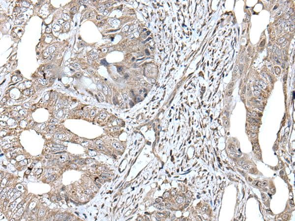RAD54B Antibody