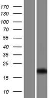 CFAP126 / C1orf192 Protein (Over-Expression Lysate Myc-DDK (Flag))