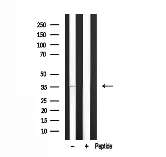 TROP2 / TACSTD2 Antibody