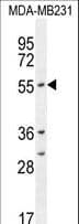 CYP2A7 Antibody (aa121-148)