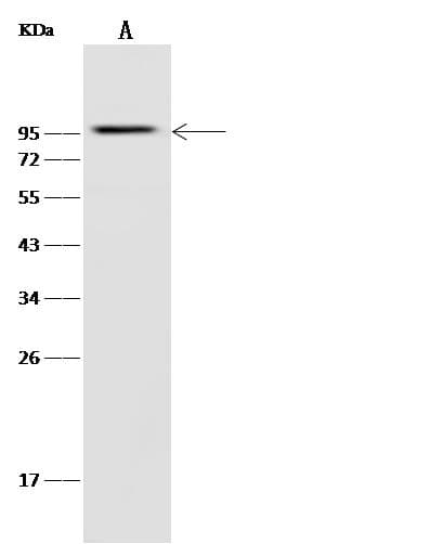 glk / Glucokinase Antibody (clone 223, Preservative Free)