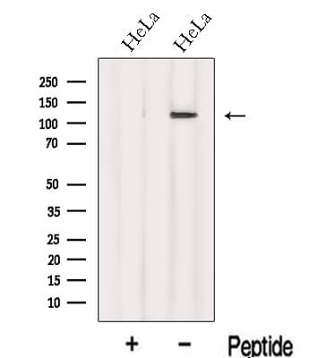 Polyclonal Rabbit anti-Human INTS8 Antibody (WB)