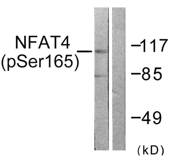 NFAT4 / NFATC3 Antibody (phospho-Ser165)