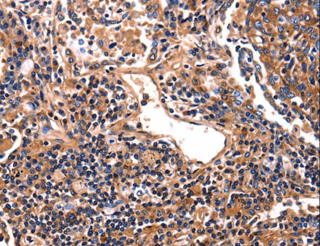 HP / Haptoglobin Antibody