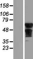 SLC6A18 / XTRP2 Protein (Over-Expression Lysate Myc-DDK (Flag))
