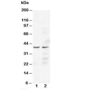 CCR5 Antibody (aa19-34)