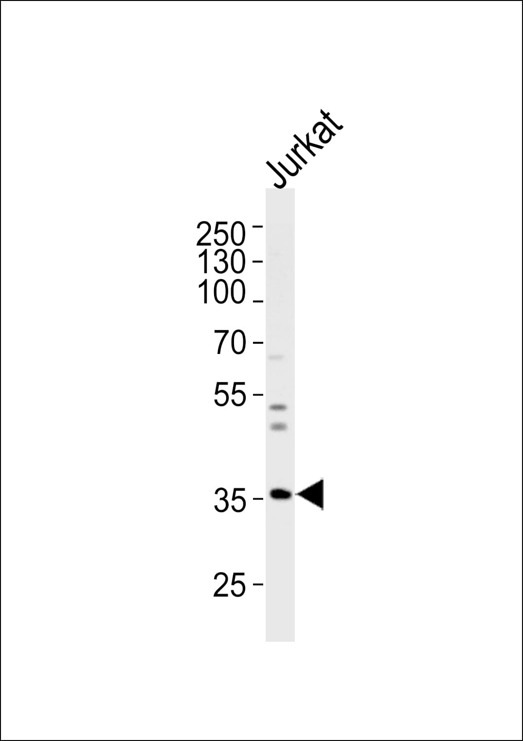 Spastic / GLRB Antibody (aa103-132)
