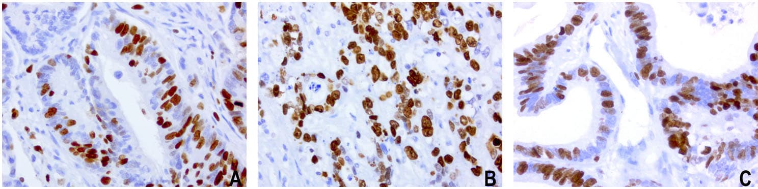 MKI67 / Ki67 Antibody (aa1160-1493, clone UMAB107, Carrier-free)