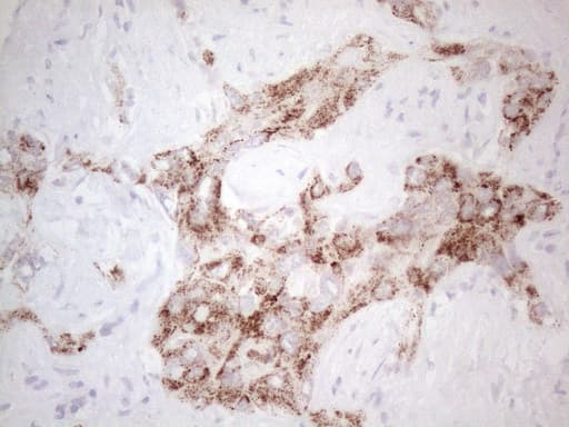 AMACR / P504S Antibody (clone OTI3E10)