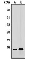 Polyclonal Rabbit anti-Human CDC42EP5 Antibody (N-Terminus, WB)