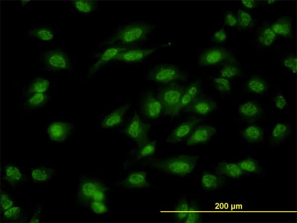 DLX1 Antibody (clone 2H3)