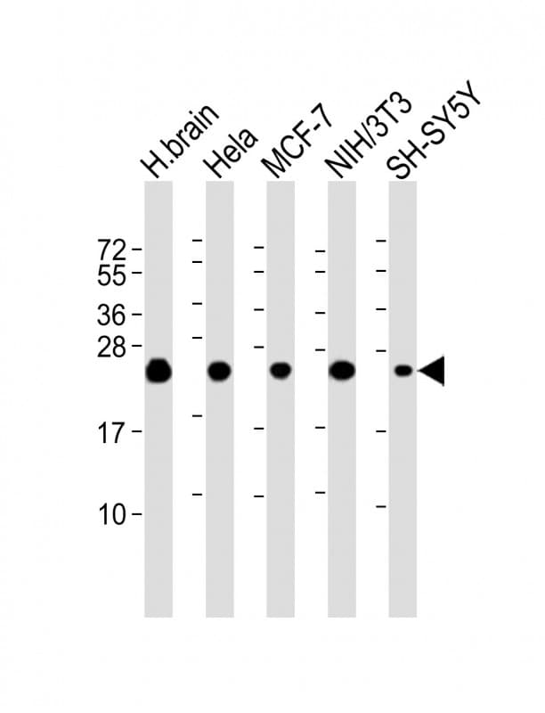 Monoclonal Mouse anti-Human SOD2 / Mn SOD Antibody (clone 1559CT572.3.83, IHC, WB)