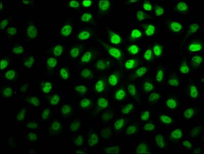 HIST1H2BN Antibody