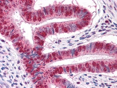 MUM1 Antibody (clone 4G10)