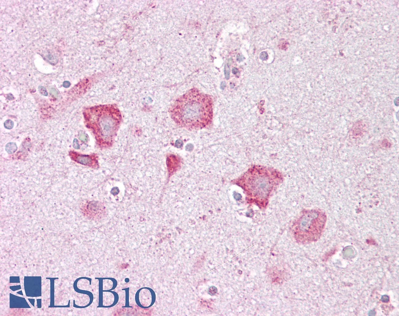 Polyclonal Rabbit anti-Human KCNQ2 Antibody (aa171-220, IHC, WB)