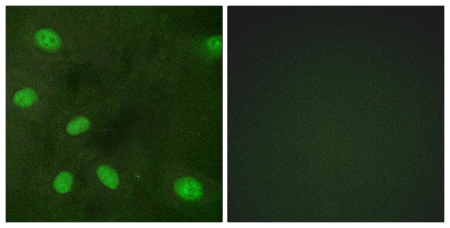 KCNJ3 / GIRK1 Antibody (phospho-Ser185)
