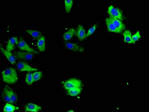IHC-plus™ TYRO3 Antibody
