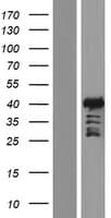 ALX3 Protein (Over-Expression Lysate Myc-DDK (Flag))