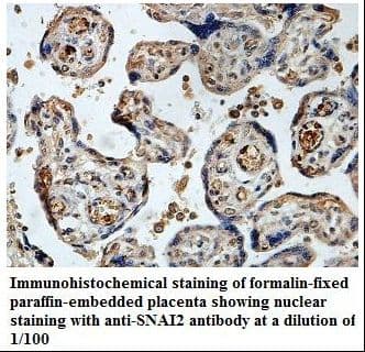 SNAI2 / SLUG Antibody (aa16-199)