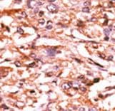 CDC25B Antibody (phospho-Ser187)