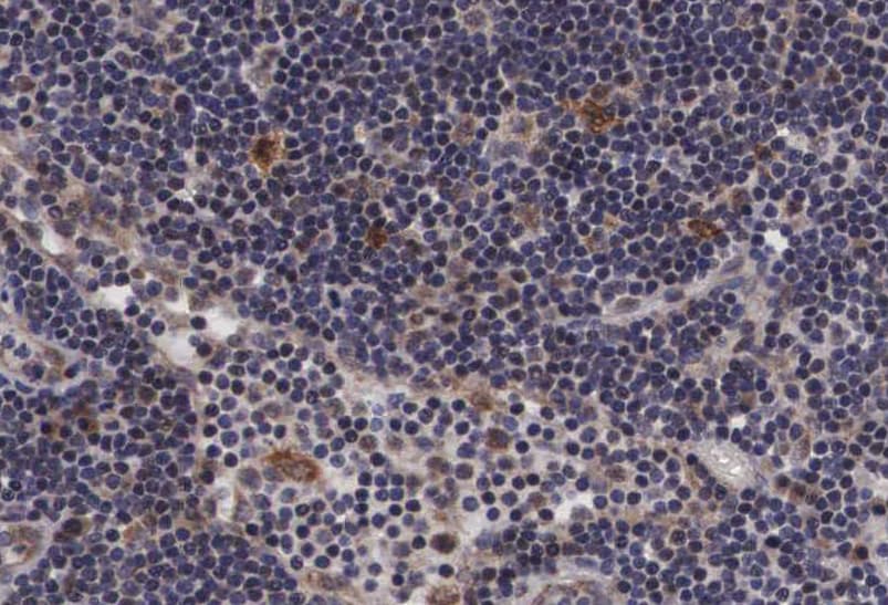 PTP1B Antibody (phospho-Ser50)