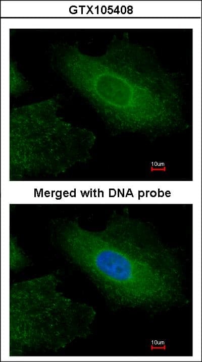 IHC-plus™ Polyclonal Rabbit anti-Human RDX / Radixin Antibody (aa95-434, IHC, WB)