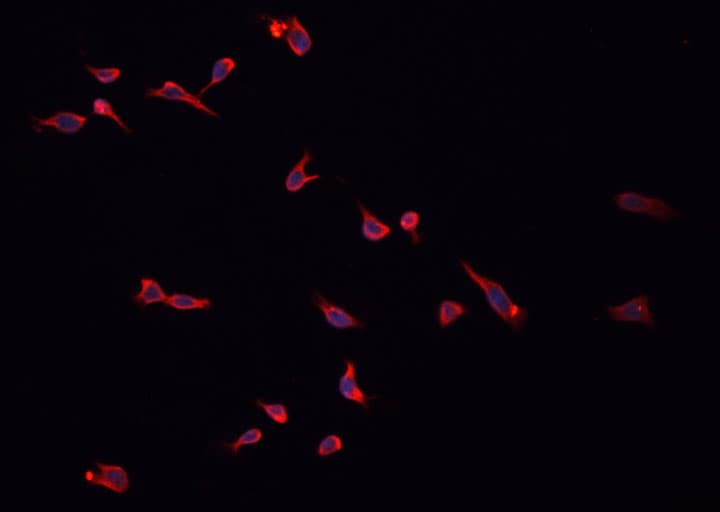 HSD3B2 Antibody