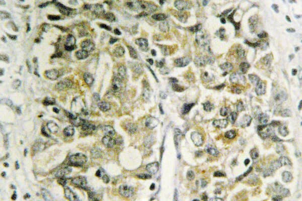 LGALS8 / Galectin 8 Antibody (Asn82)