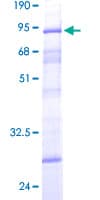 Human DCP2 Protein (Recombinant GST)